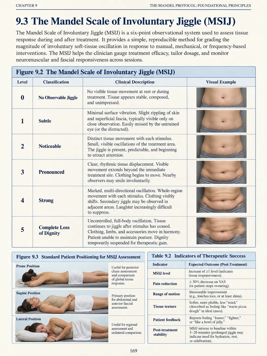 Ebook sample page: The Mandel Scale of Involuntary Jiggle